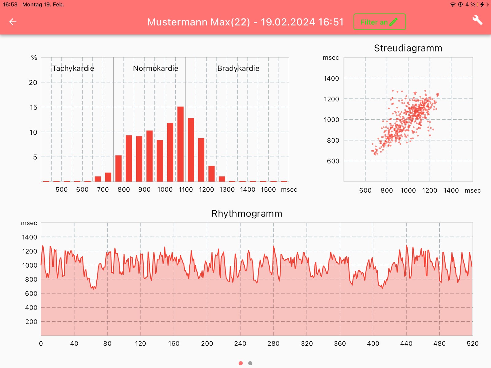 HRV-Auswertung auf dem Tablet mit Histogramm, Streudiagramm und Rhythmogramm