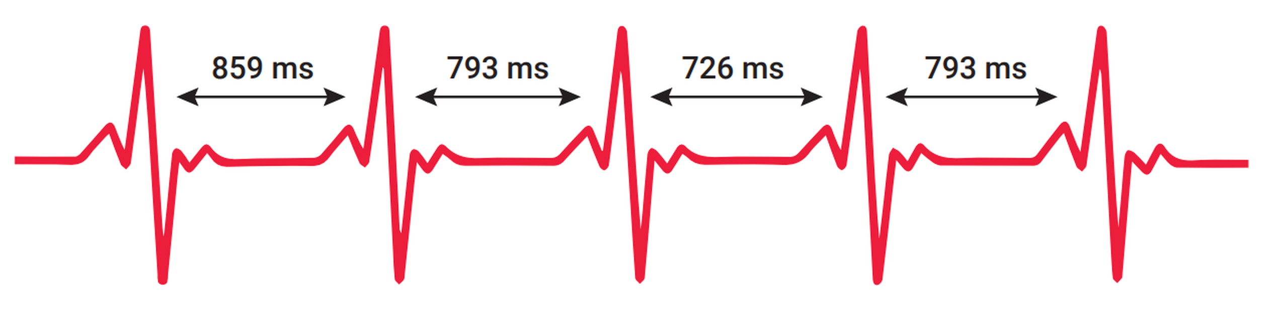 EKG-Kurve mit eingezeichneten Abständen zwischen den Herzschlägen in Millisekunden